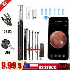 Ear Wax Removal Camera Ultra-HD Ear Wax Remover Tool, Ear Cleaner Washer kits v