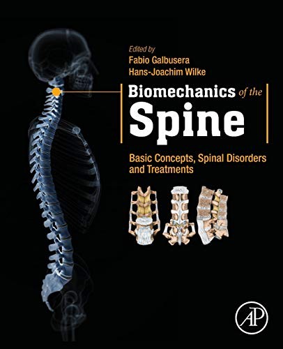 Biomechanics of the Spine: Basic Concepts, Spin, Galbusera, Wilke,#