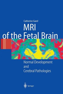 MRI of the Fetal Brain Normal Development and Cerebral Pathologies C. Garel Buch
