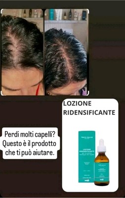 SECHS FRAUEN UND HAARE VERLIEREN? VERDICHTENDE LOTION - TRICO-SALUS SOLUTION SNEP