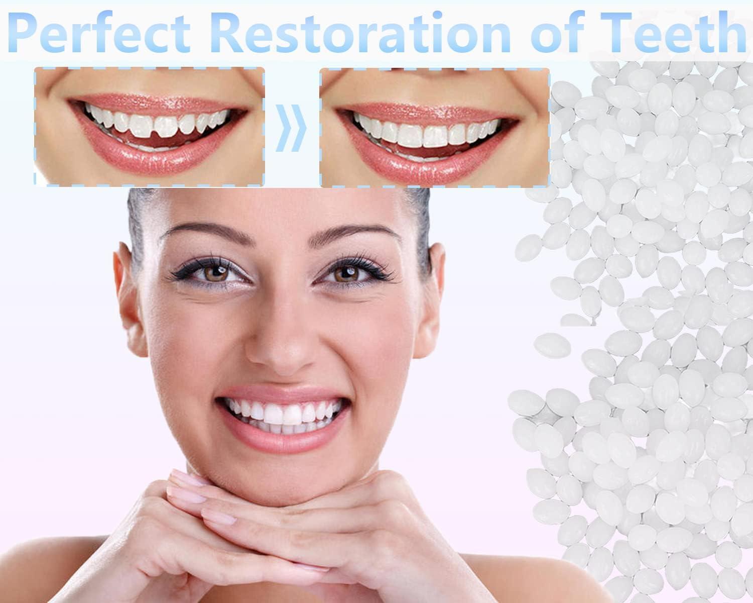 Strong Teeth Tooth Repair Beads Dental Cavity Filling Kit For Chipped