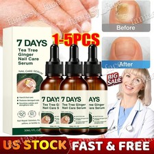 7DAYS Nail Fungus Treatment Serum Care Hand and Foot Care Removal 30ml Pack1-5