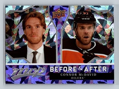 2021-22 Upper Deck MVP - Before and after Connor McDavid #BA-2