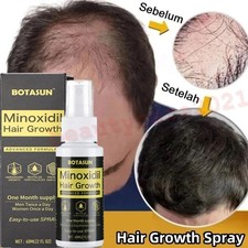 60mL Minoxidil 5% Men Hair Growth Spray Serum for Healthier and Thicker Hair UK