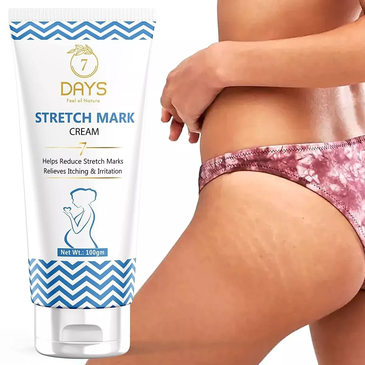 Best cream for old stretch marks online