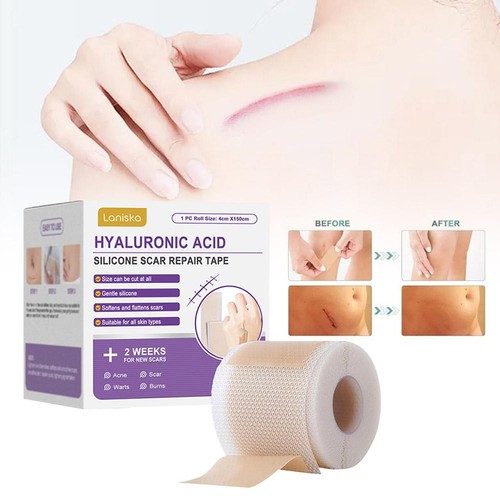 Silicone Scar Sheet Wrinkles & Improve Scar Status | Repair Nursing Patch- Au - Picture 6 of 15