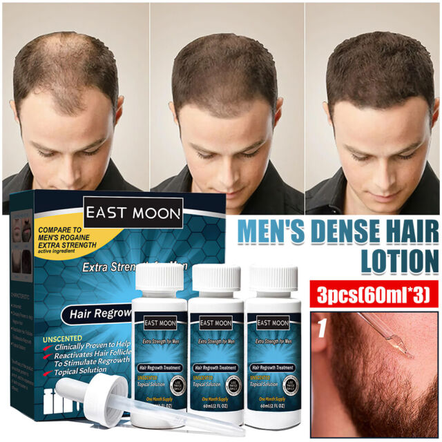 Costco Branded Generic Minoxidil 5% Mens Hair Loss Drops Treatment 3 Months