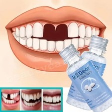 2X Tooth Repair Kit Temporary Teeth Replacement Beads for Missing & Broken Teeth