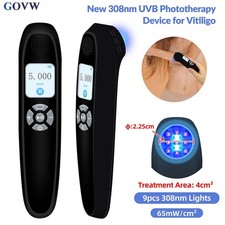 308nm Narrowband UVB Light Therapy 65mW/cm2 Handheld Skin Care Device for Home