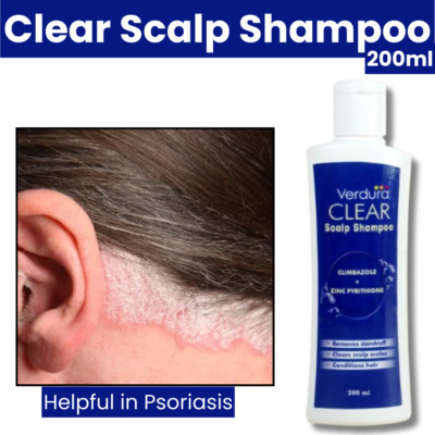 Psoriasis Shampoo für trockene Kopfhaut Psoriasis Kopfhautbehandlung natürliche pflanzliche Linderung