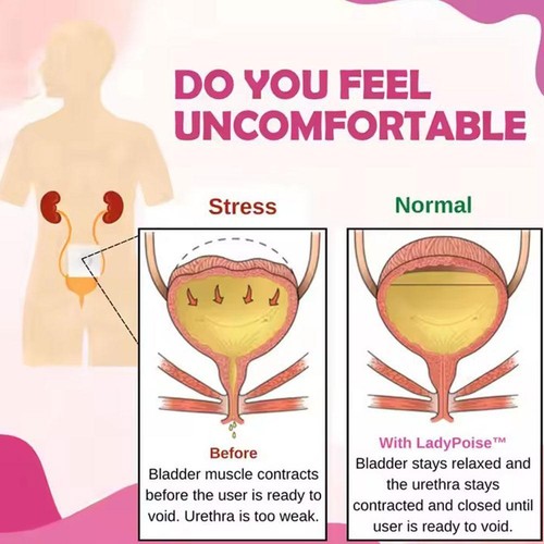Women Urine Leakage Patch Wormwood Urinary Incontinence Bladder Control - Picture 3 of 12