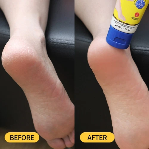 Crema para pies Aavini 50 g - Repara tacones agrietados | Hidratante y antibacteriana - Foto 10 de 16
