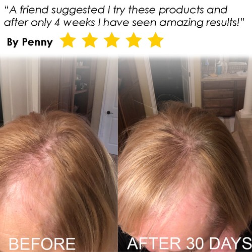 Biotin Vitamin Shampoo & Conditioner Set For Hair Growth, Sulfate Free Cucumber - Picture 30 of 68