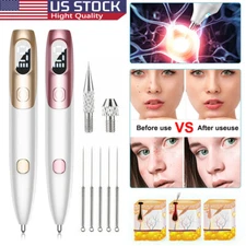 Electric Laser Plasma Pen Mole Removal Dark Spot Skin Wart Tag Tattoo Remover