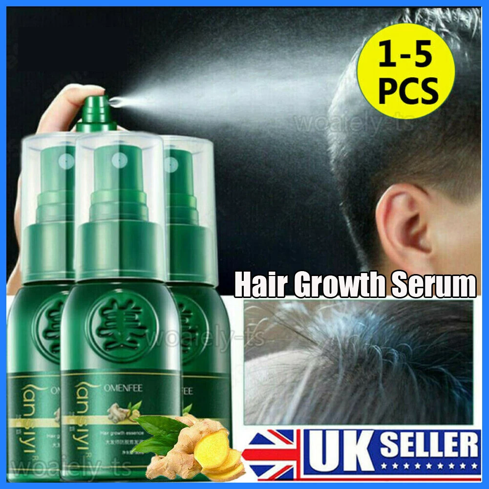 Details more than 114 hair regrowth quora super hot camera.edu.vn