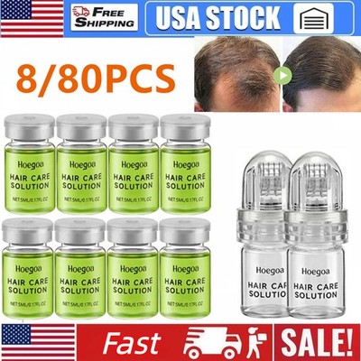 80X Advanced Hair Growth Serum Ginseng Solution Set Anti Hair Loss Fast Regrowth