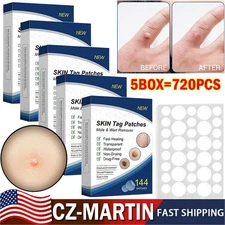 720× Skin Tag Remover Patches Quick Effective Mole Wart Removal Pad Sticker