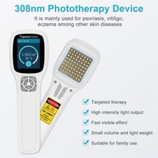 Sistema Excímero 308nm en Dermatología Fototerapia para Enfermedades de la Piel