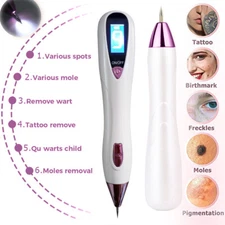 Maquina Laser Para Eliminiar Verrugas Sacar Puntos Negros Quitar Manchas De Cara