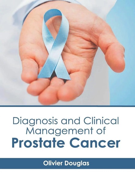 Diagnosis And Clinical Management Of Prostate Cancer | Olivier Douglas | Buch-image