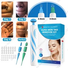 2 in 1 Safe Painless Auto Micro Regular Warts Skin Tag Removal Kit for 1-8mm