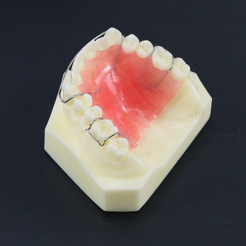 Modello dentale Hawley la struttura del fermo dentista insegna igiene orale modello - Foto 7 di 8
