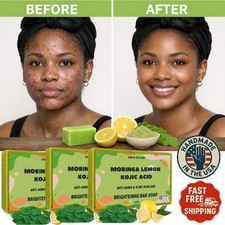Antiaging Wrinkle Acne Brightening Soap Bar Moringa Lemon Kojic Acid 4oz -3 PACK