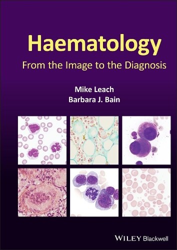 Mike Leach Barbara J. Bain Haematology (Copertina rigida)