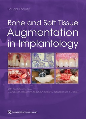 Bone and Soft Tissue Augmentation in Implantology Fouad Khoury