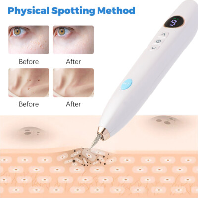 9 Modes Age Spots Removal Skin Mole Wart Freckle Tattoo Remover Pen w/5 Needles