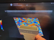 GE ML-6-15-D probe for GE Voluson E8 , E10, E6 , Logic E9 Ultrasound -  Warranty