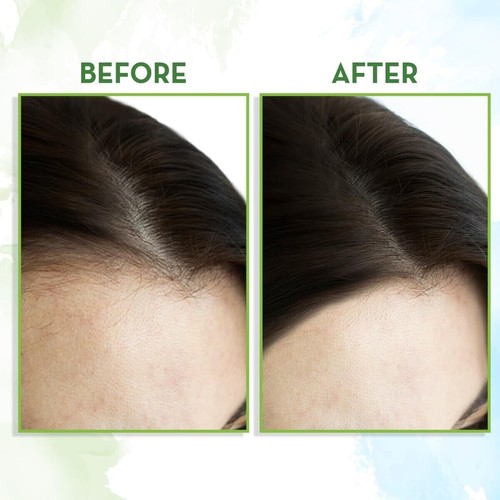 Mamaearth Rosemary Hair Growth Oil with Rosemary & Methi Dana | 150 ML - Picture 3 of 9