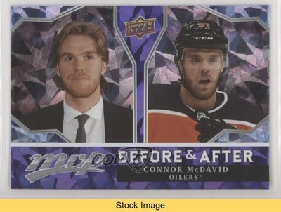 2021-22 Upper Deck MVP Before and After Connor McDavid #BA-2 READ kh0