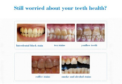 Teeth Whitening Essence EFERO Bleach Liquid Teeth Stains Dental Plaque Cleaning - 第 10/16 張圖片