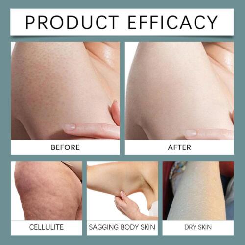 60ml Lifting Körperöl Straffend Reduziert Cellulite Falten Dehnungsstreifen 2025 - Bild 16 von 18