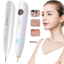 Multifunction Laser Plasma Pen Facial Body Dark Spot Mole Tattoo Removal Machine