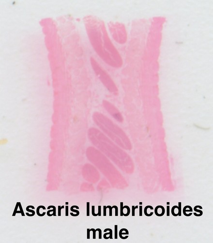 PARASITE Microscope Slide Set DEADLY DISEASE Insect WHOLE MOUNT Helminth Worm - Picture 7 of 7