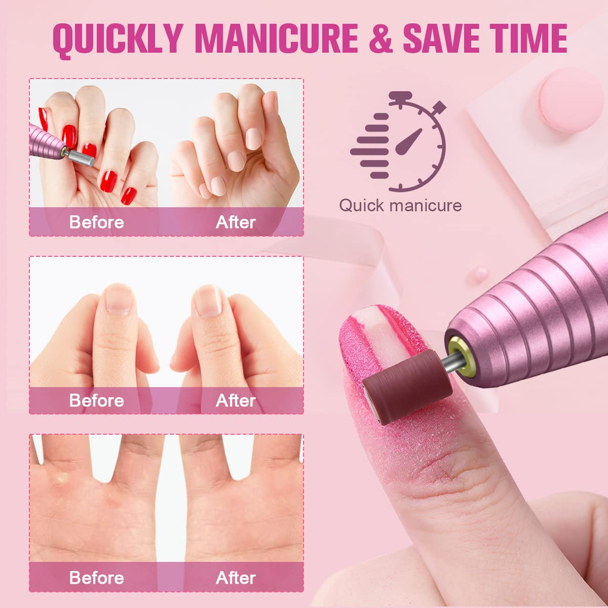 Toe Nail Grinder for Thick Toenails Set Manicure and Pedicure