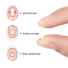 50Pcs Ingrown Toenail Corrector Toe Foot Nail Correction Sticker Pedicure Tool
