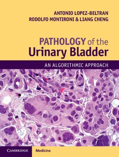 Pathology of the Urinary Bladder An Algorithmic Approach Lopez-Beltran Montironi