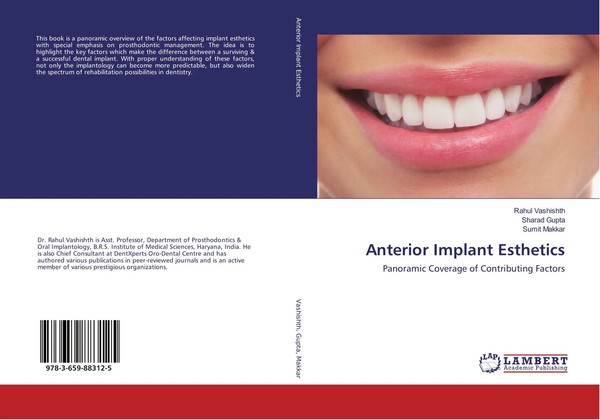 Rahul Vashishth (U. A.) | Anterior Implant Esthetics | Taschenbuch | Englisch-image