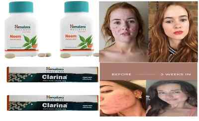 Himalaya Neem Tablets & Clarina anti acne cream 60 x 2 & 30g x 2 FREE SHIP 2026