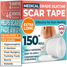 Medical Grade Silicone Scar Tape Transparent 1.6x150 Reusable Silicone Sheets Ke