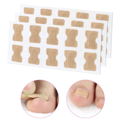 Kleberfrei Zehennagel Zehen Eingewachsen Nagel Korrektur Pflaster Nagelsticker Profi