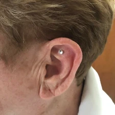 Weight Loss Diamond Like Magnets Acupressure Ear Therapy 1 New Kit 2025 Success