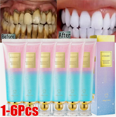 Niacinamide Whitening Toothpaste Natural Niacinamide Toothpaste, Teeth Whitening