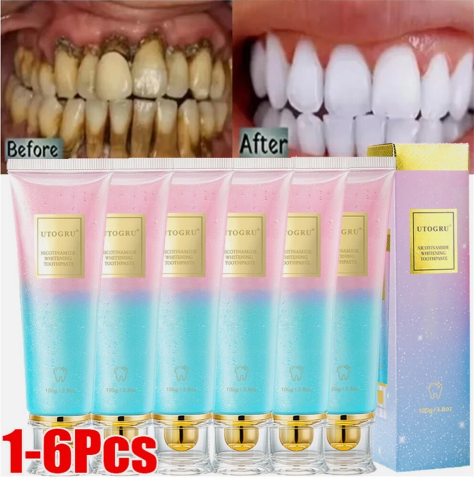 UTOGRU Niacinamide Whitening Toothpaste Natural Niacinamide Toothpaste, Teeth Whitening