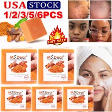 1-6x Tumeric Soap Skin Whitening Dark Spots lightening Acne Brightening Turmeric