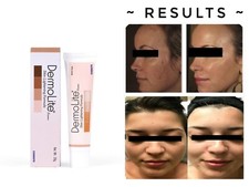 Original Skin Whitening And Brightening Cream For Dark spot 20 Gm All Types Skin