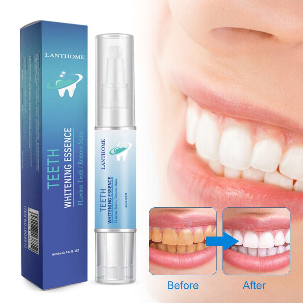 Teeth whitening Branded goods remove stains whi coffee tea teeth Excellence